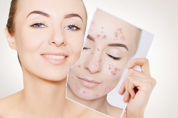 Frau zeigt Hautverbesserung