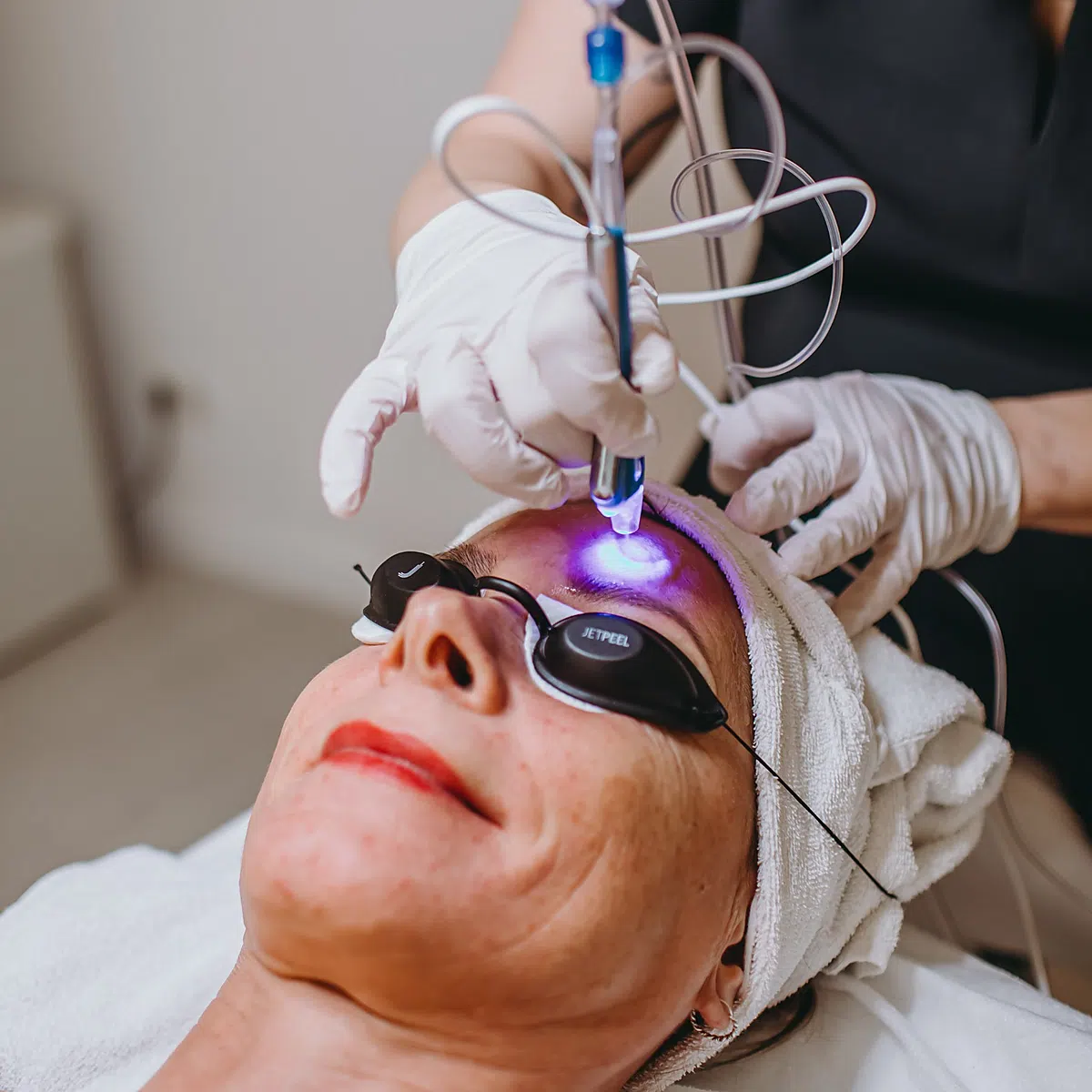 Behandlung mit der Sirius von Candela