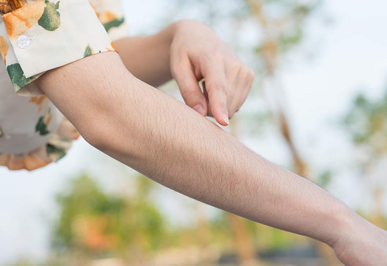 fachzentrum-fuer-aesthetik.de-Hirsutismus-Behandlung-Was-tun-bei-zu-starker-Koerperbehaarung