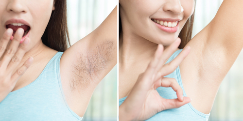 Asia,Beauty,Woman,With,Armpit,Plucking,Problem,Before,And,After